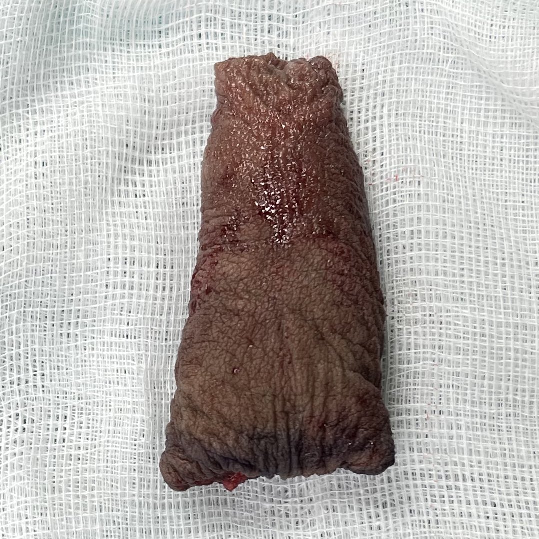 Dr.Nut Jirawee tweet media