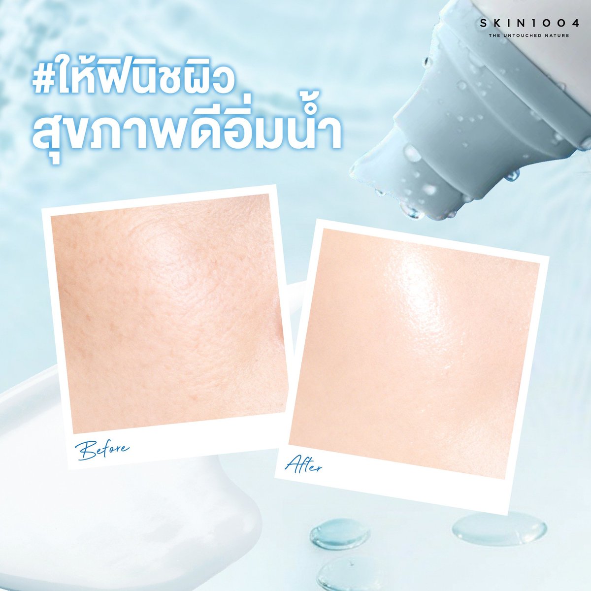 Skin1004_Th's tweet photo. แดดแรงแค่ไหนก็ไม่กลัว! 
กู้ผิวฉ่ำโกลว์ด้วย "กันแดดไฮยา" หลอดเดียวจบ 
Madagascar Centella Hyalu-Cica Water-Fit Sun Serum หลอดนี้คือที่สุดของความปัง! ที่รวม "การปกป้อง" และ "การบำรุง" ไว้ในหลอดเดียว https://t.co/Y3Dd7XPTJA