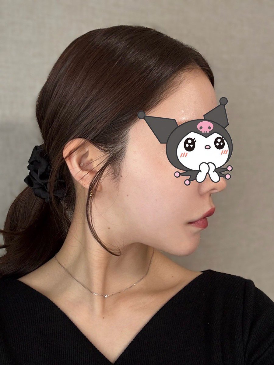 유ちゃん tweet media