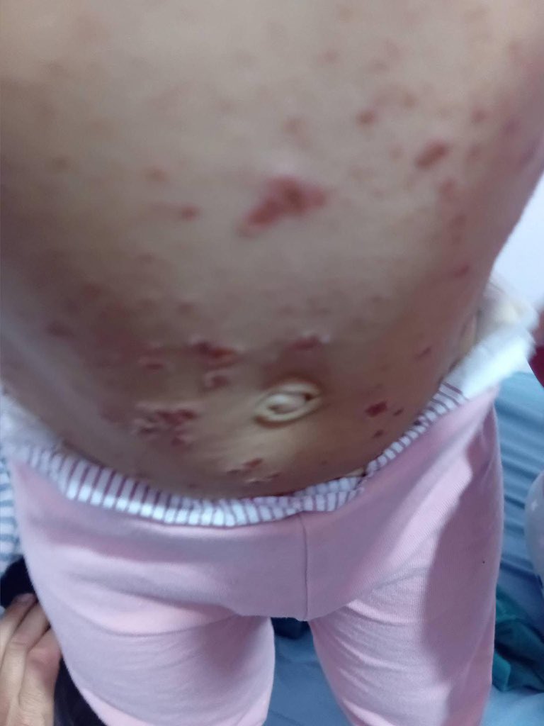 Mera. mohammed tweet media