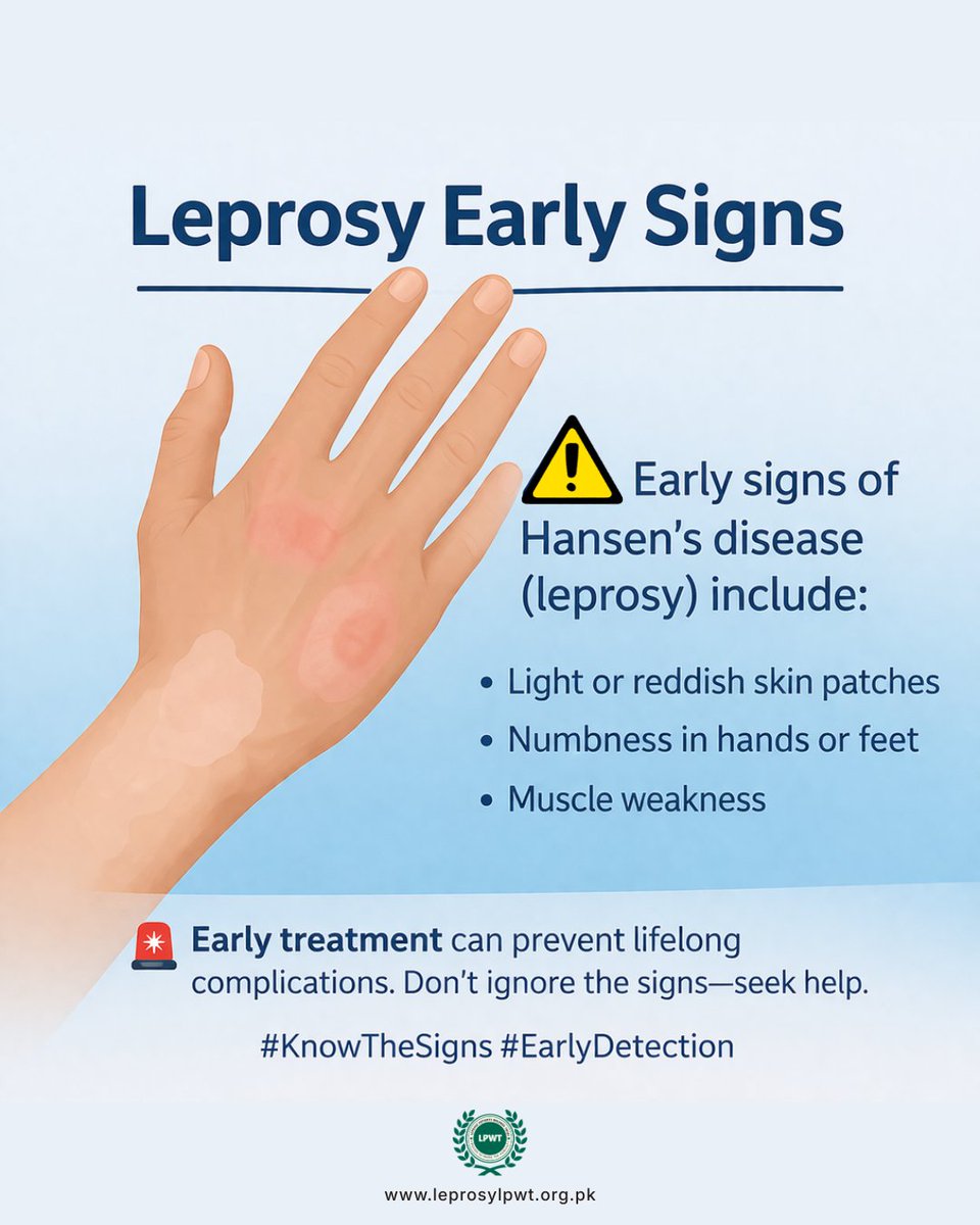 leprosylpwt's tweet image. Hansen’s disease can start subtly—don’t miss the signs:
• Light/reddish skin patches
• Numbness in hands/feet
• Muscle weakness
🚨 It’s curable, and early treatment prevents disability.
Awareness saves lives—share to help others.
#KnowTheSigns #EarlyDetection #LeprosyAwareness
