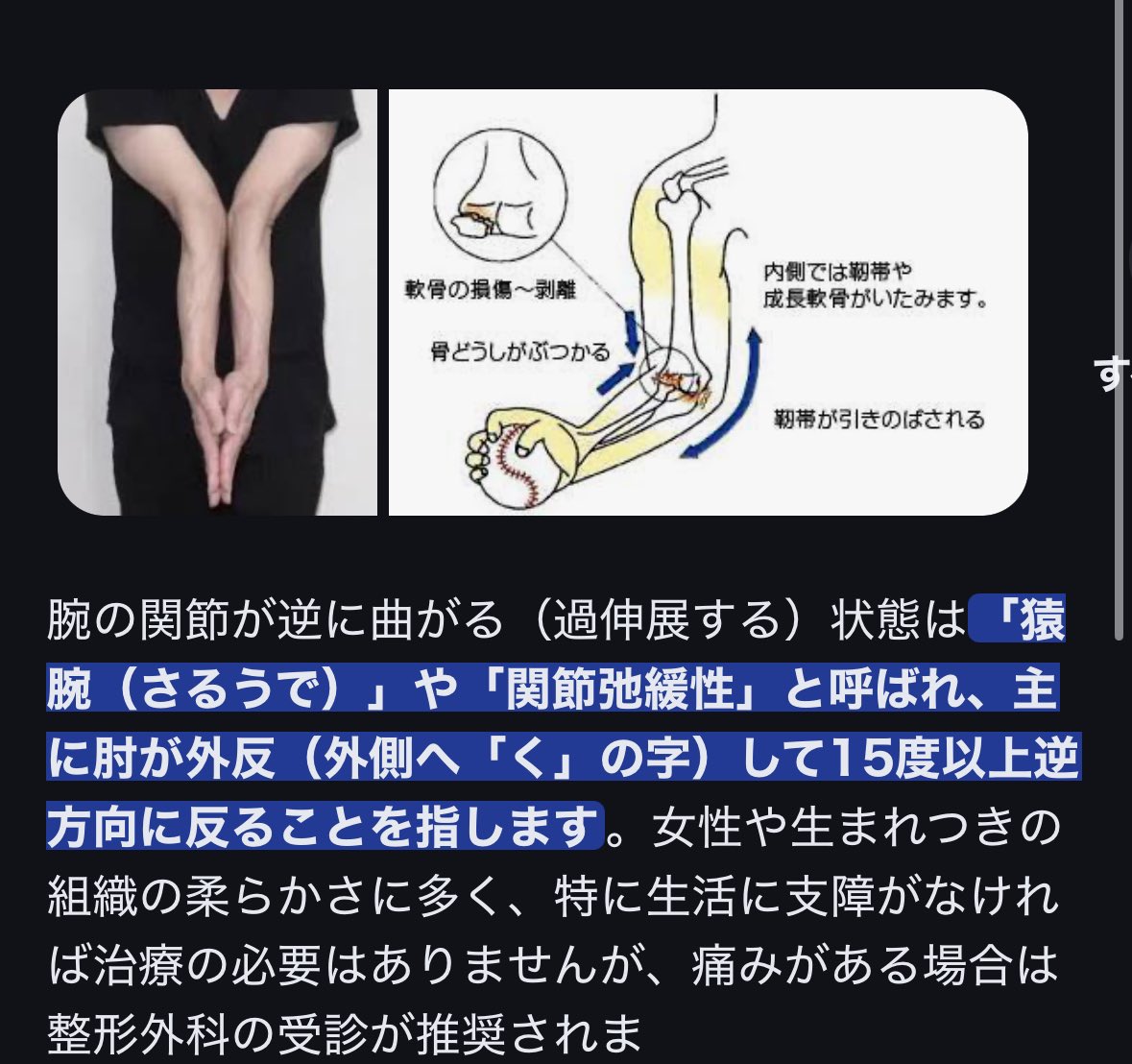 GAM⚠️🍻隠酒狐 tweet media