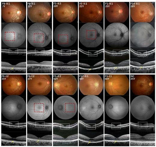 TVST Journal tweet media