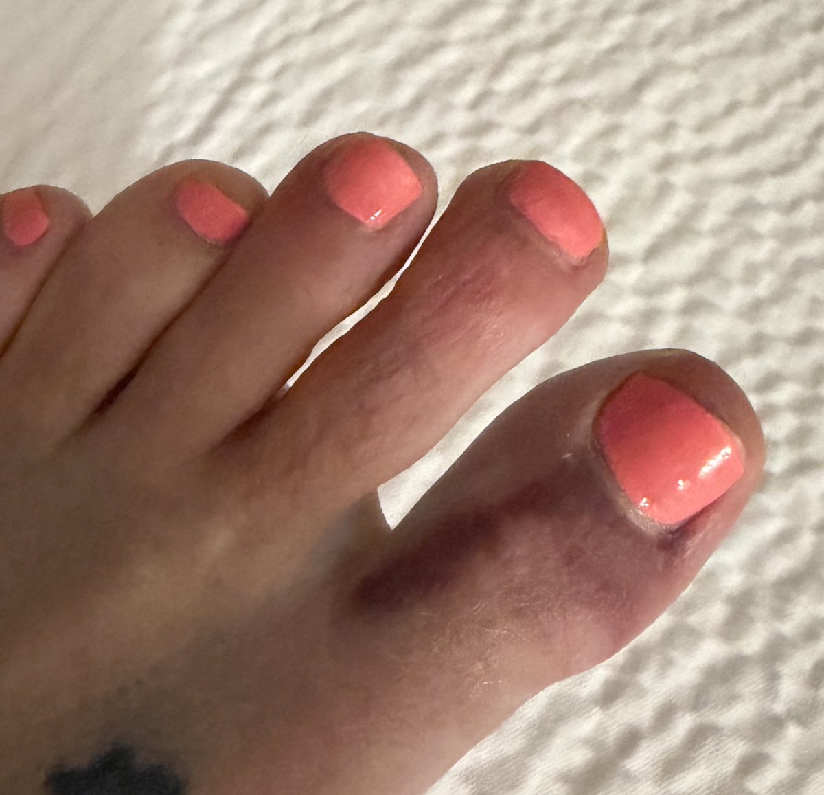 VickyRichterUSA's tweet image. Day three at @CPAC —still standing and limping, remarkably 🫡
Toe’s in simply splendid condition, obviously 😂
But we all know the show must go on 😂😂
Carrying on in @KarlLagerfeld meets @adidasoriginals … because someone has to uphold German fashion standards 🇩🇪❤️ 
Make German