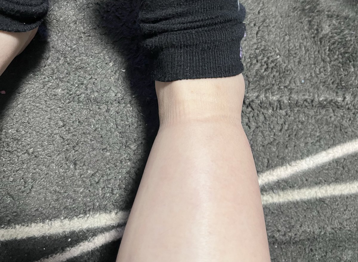 うめすけ®︎◆🎀5y＋🥚25w tweet media