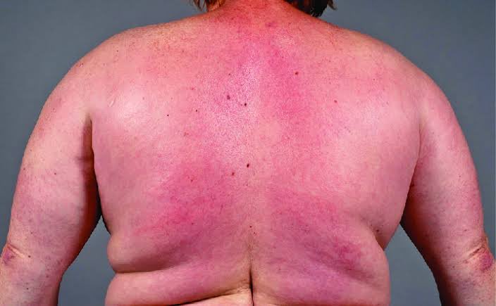 Arun Lol tweet media