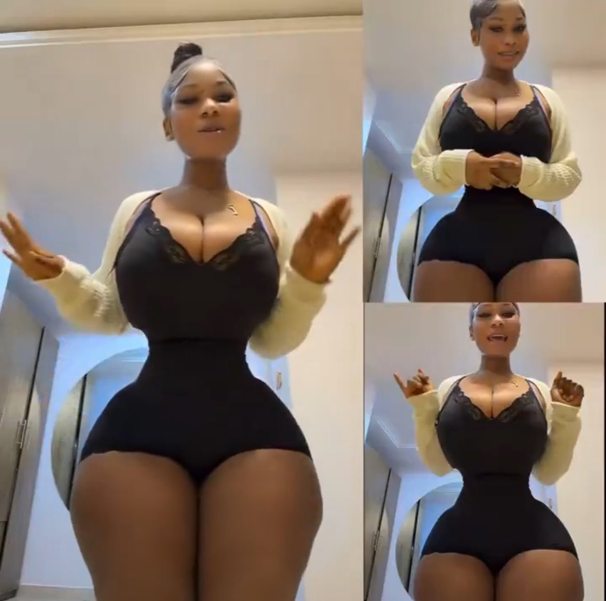She removed 20 of her Ribs