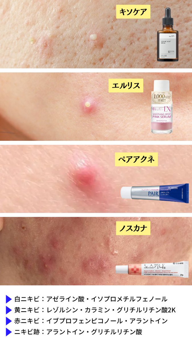 𝐤𝐢𝐤𝐢 tweet media