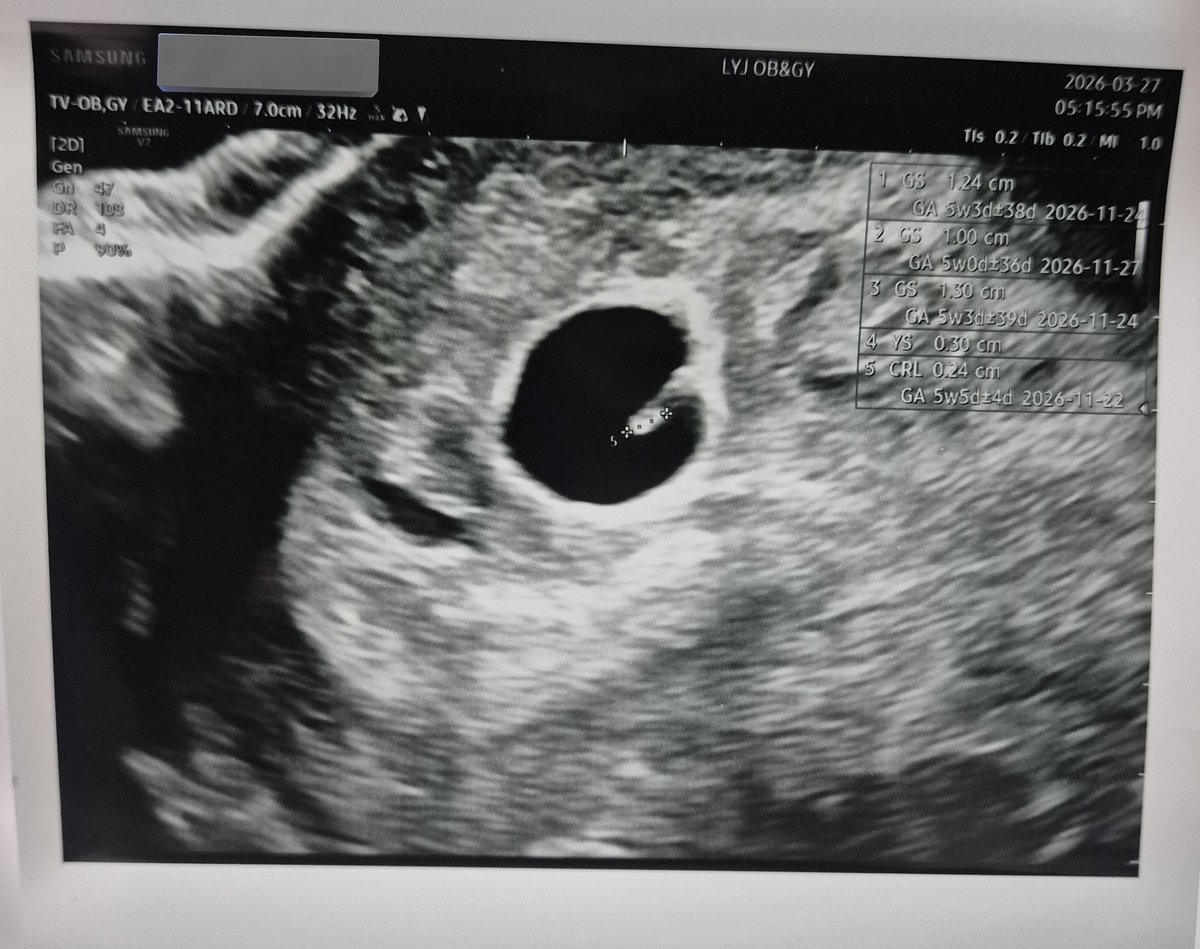 참치먹은 물범 🦭 tweet media