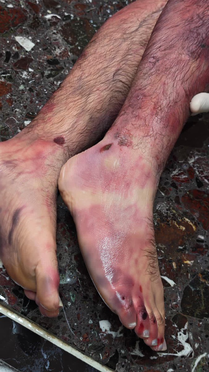 حـســـن الــسـتري 🇧🇭🇦🇺 tweet media