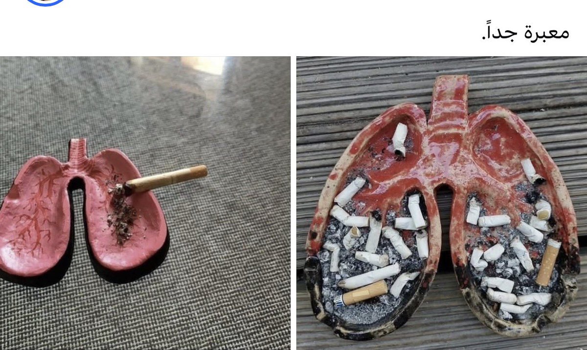 بتر الخواطر tweet media