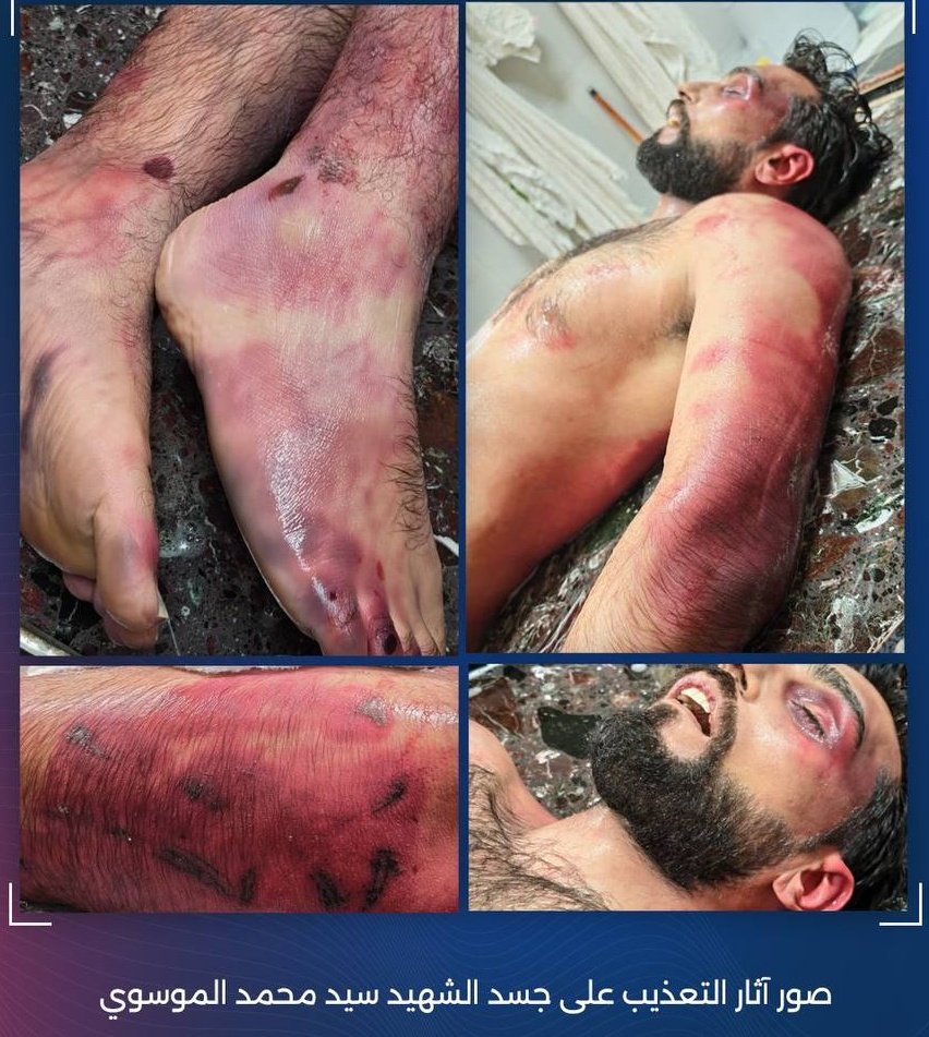 sayedalnoor's tweet photo. المجرمين #آل_خليفة
على نهج جدهم يزيد

قتلوا شابا بعمر الزهور
بتهمة التعاطف مع #ايران
بالتنكيل والتعذيب !

هل يظن اي من اهل #الكويت و #البحرين
ان صمتكم سيحميكم ؟

الدور الياي عليكم بكل طوايفكم اقسم بالله 

خنشوف #فهد_اليوسف_الصباح 
شمسوي حاليا بالمساجين الشيعة اللي
اتهمهم #الخلايا_النايمة!

اين مساجين الكويت وماذا حل بهم ؟

#مطار_الكويت_الدولي 
#الحرس_الوطني
#الكويت_الان
#پاکستان #صوت_الرعد 
#الدفاع_الجوي_الكويتي
#صباح_الخير_ياكويت
#حسين_المعتوق
#صوت_المطر
#مضیق_هرمز
#الذهب 
#خونة_الوطن
#الخلية_الارهابية
#مشعل_الأحمد #الجهراء
#الخلايا_النايمة
#سحب_الجناسي  
#الجبيل #البدون #الرياض_الان #طهران #إسرائيل #صفارات_الإنذار
#الامارات #ترامب #خامنئي
#Iran
#الجيش_الكويتي
#الجنوب #شهداء_الواجب
#قطر #قاعدة_علي_السالم 
#فهد_اليوسف
#الازهر #فاطمه #اللهم_بفاطمه #السيسي #خطبة_العيد
#فؤاد_الهاشم
#الجنسيه_الايرانيه #ميناء_الشويخ