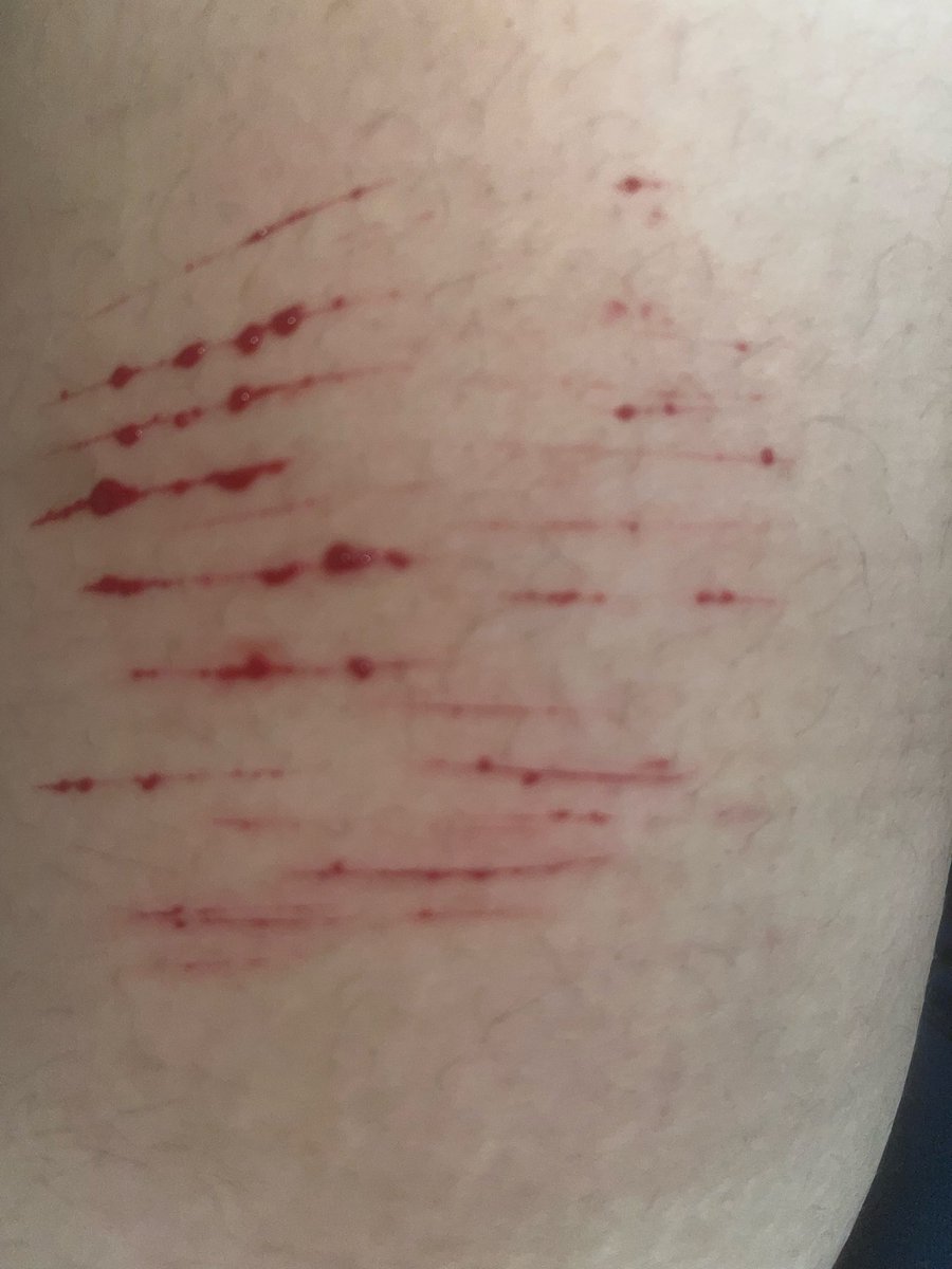 🍫 𝒸yn ♡’s 𝓂ello (SHEDTWT) 🪽 tweet media