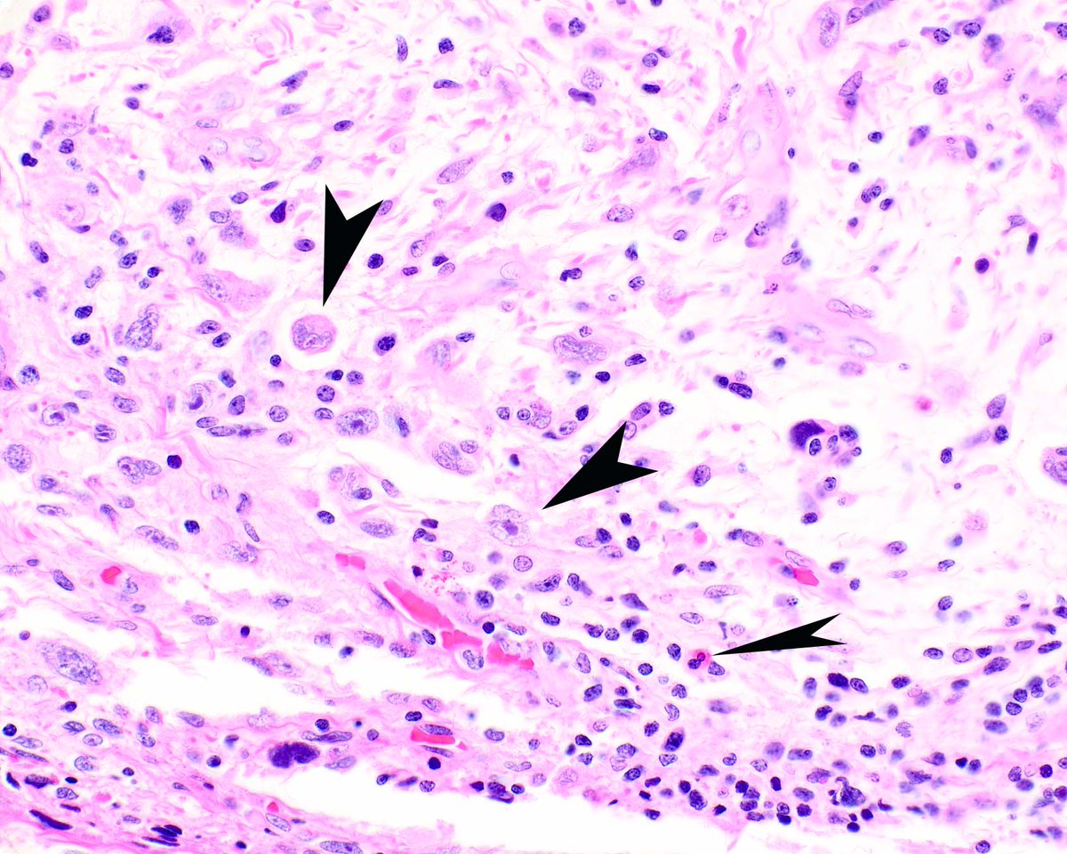 Modern Pathology tweet media
