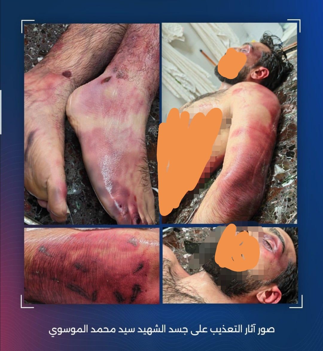 بال2011 الشعب العربي دعم ماأسماهم"ثوار" في سورية-المدعومين من الصهاينة-ضد "نظام"بشار الأسد،فيما بال2014 اتهموا ثوار البحرين ضد نظامهم العميل والمستبد والسفاح بالتبعيةلجهات خارجية-ايران-(وهو شرف)لأن موقفهم من الكيان ومن التطبيع واضح.كل من صمت عن مظلوميةهؤلاءسيقف أمام الله وسيحاسب!