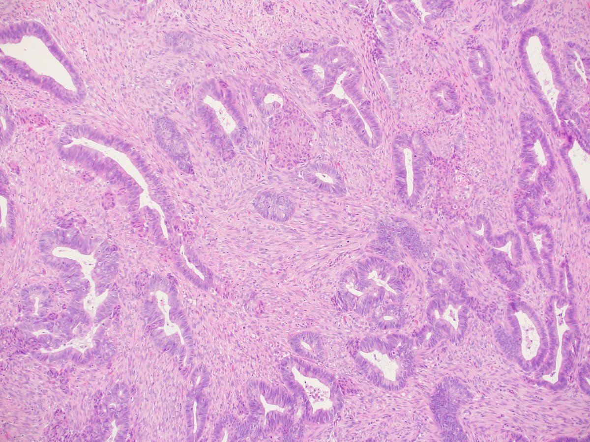 Charlie Herndon tweet media