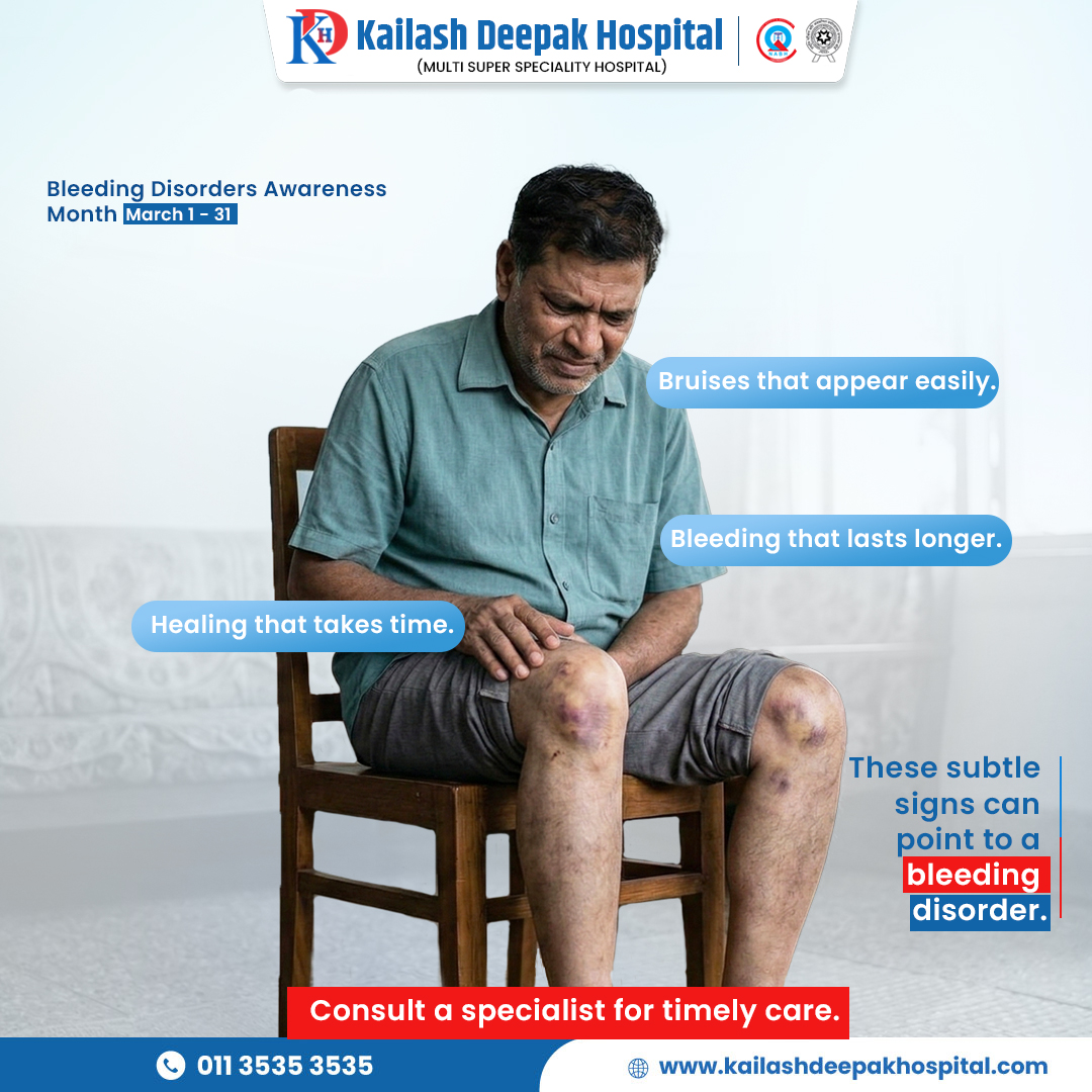 KDHDelhi's tweet image. Subtle signs, serious impact. 🩸

Bruises that appear easily or bleeding that lasts longer shouldn't be ignored. Bleeding Disorders can be really concerning!

Consult a specialist today for timely care: kailashdeepakhospital.com

#KailashDeepakHospital #HematologyCare