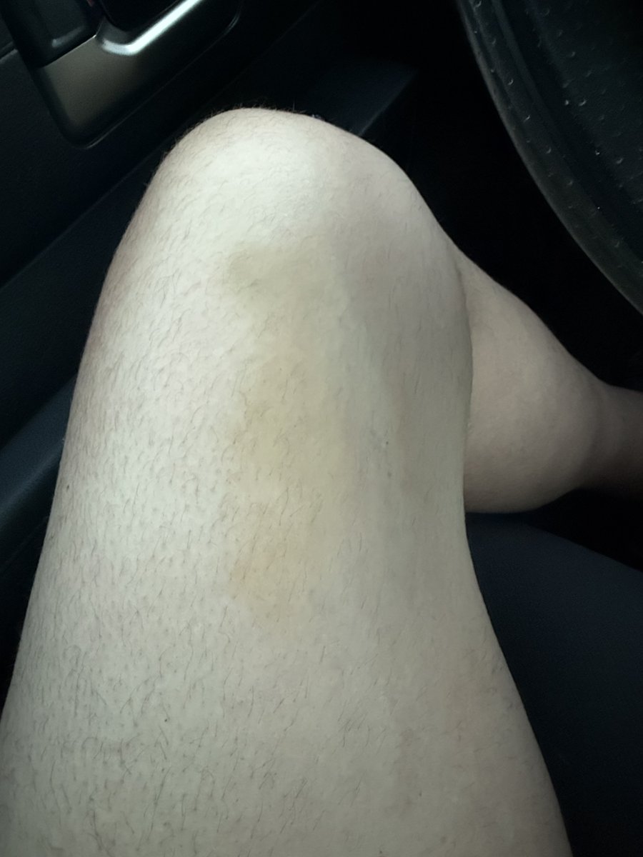 BDJuggler tweet media