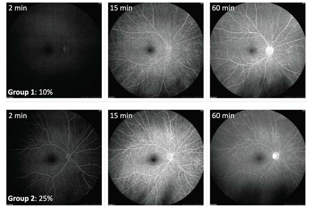 Retina Specialist tweet media