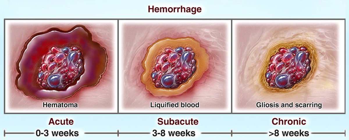 Michael T. Lawton, MD tweet media