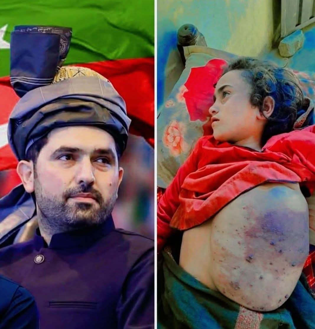 اپیل بنام وزیر اعلیٰ سہیل آفریدی
محترم وزیر اعلیٰ خیبرپختونخوا سہیل آفریدی 
نہایت دردِ دل اور عاجزی کے ساتھ آپ کی خدمت میں ایک بے بس بچی کی زندگی بچانے کی اپیل پیش کی جا رہی ہے۔ ضلع باجوڑ، تحصیل سلارزئی، علاقہ غاخی سے تعلق رکھنے والے نہایت غریب شخص خان بادشاہ کی کمسن بیٹی مناحل