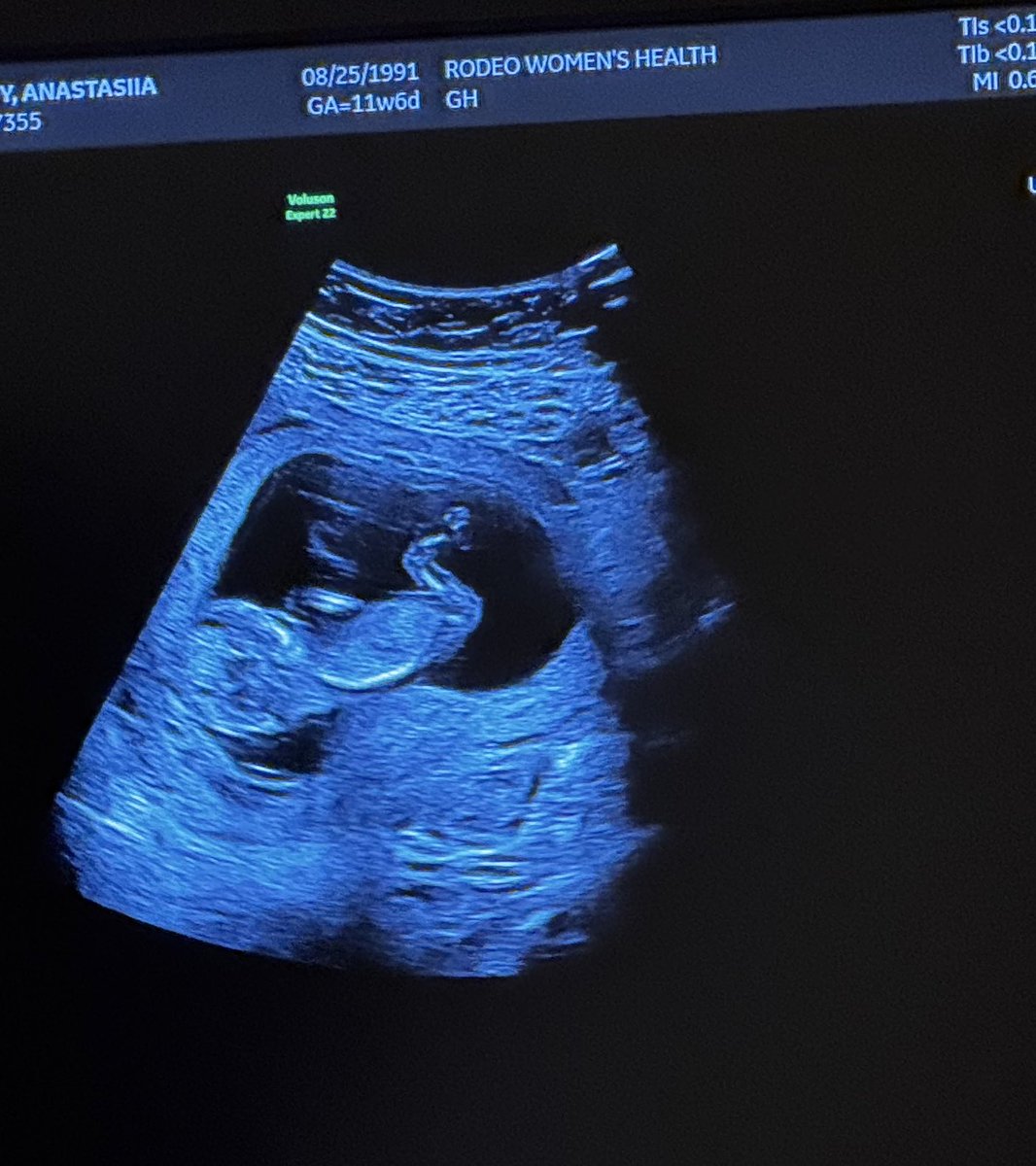 UNCLE 🏴‍☠️ EDDIE 🫵😹 tweet media