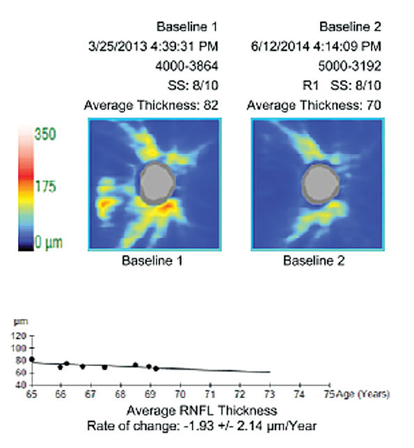 Review of Optometry tweet media