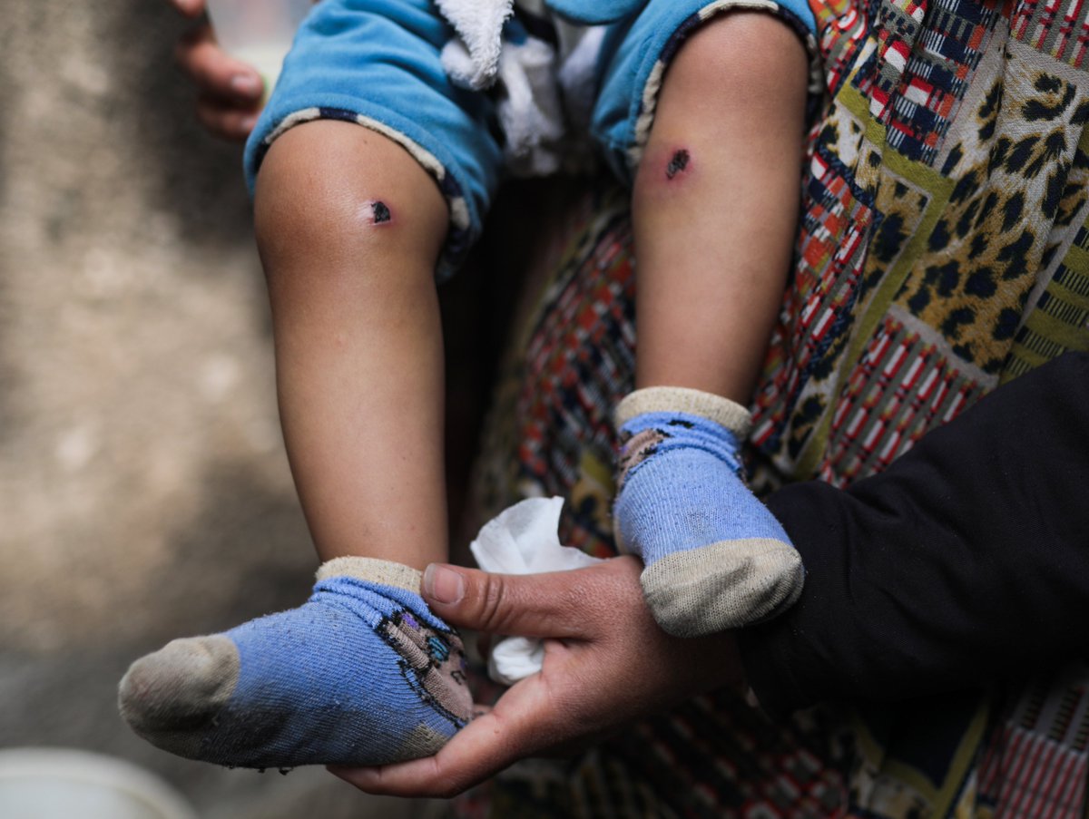Israeli soldiers tortured a baby in front of his father.