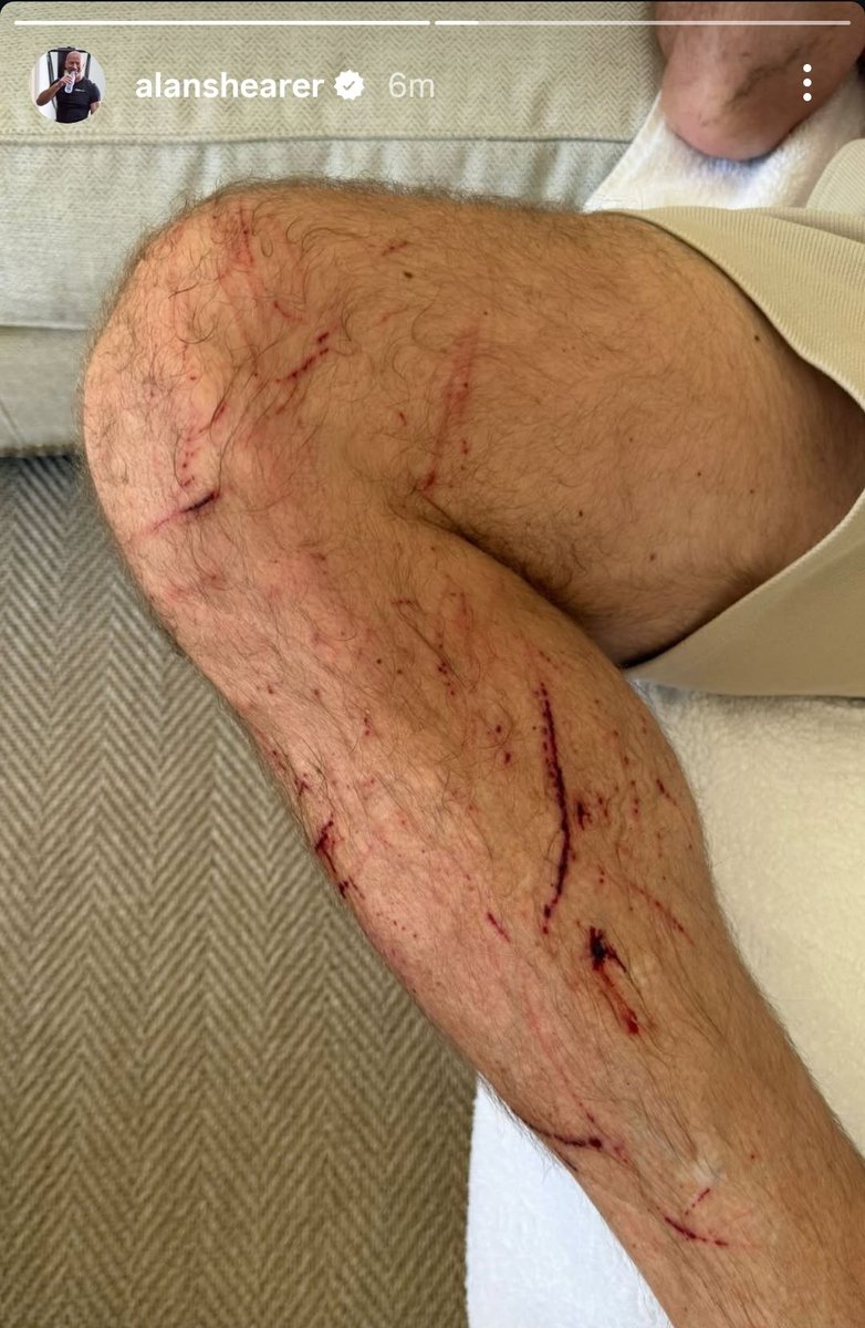 𝙂𝙚𝙤𝙧𝙙𝙞𝙚 𝙍𝙚𝙜𝙞𝙨𝙩𝙖 tweet media