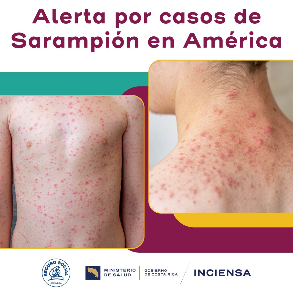 Ministerio de Salud de Costa Rica tweet media