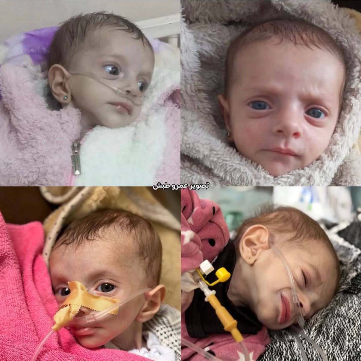 🚨 HEARTBREAKING: Infant girl Alma Abu Reda died after her health deteriorated from a severe lung disease while waiting to travel abroad for treatment under the Israeli war and siege on the Gaza Strip.