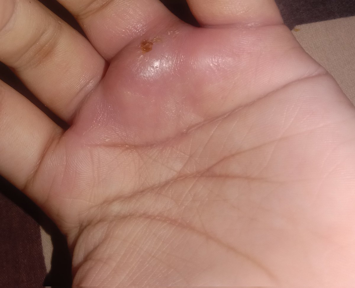 CIYOO.ᐟ★ tweet media