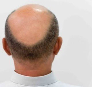 DEYI 💻🖤 tweet media