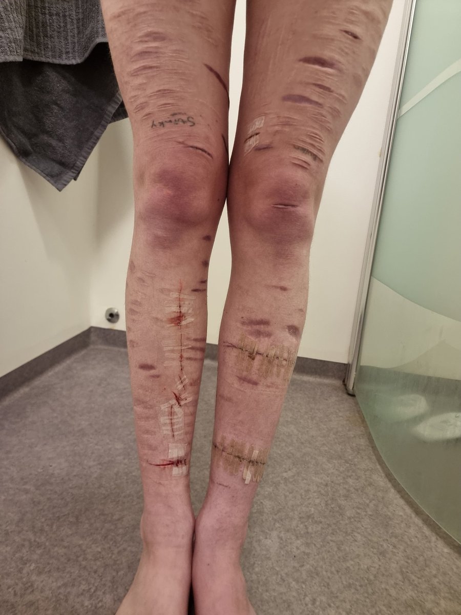 10K|| I love Bill Kaulitz || him tweet media