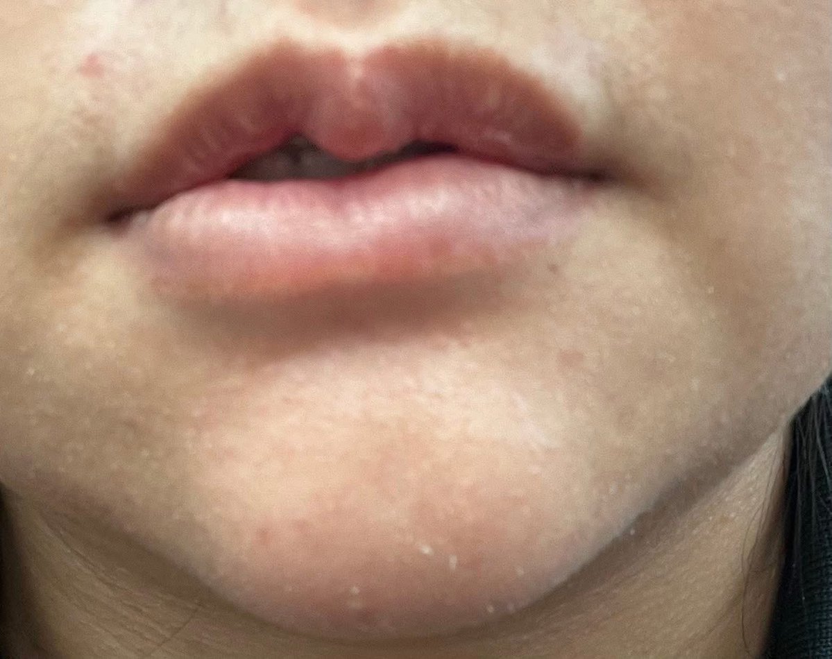 Red Skull tweet media