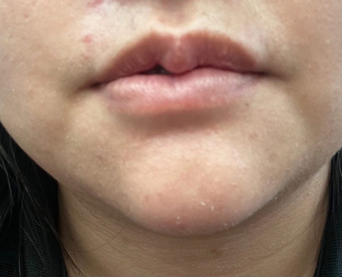 Red Skull tweet media