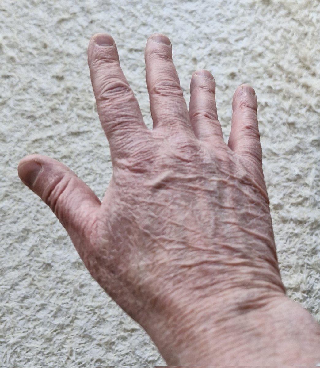 Bengt Eklund tweet media