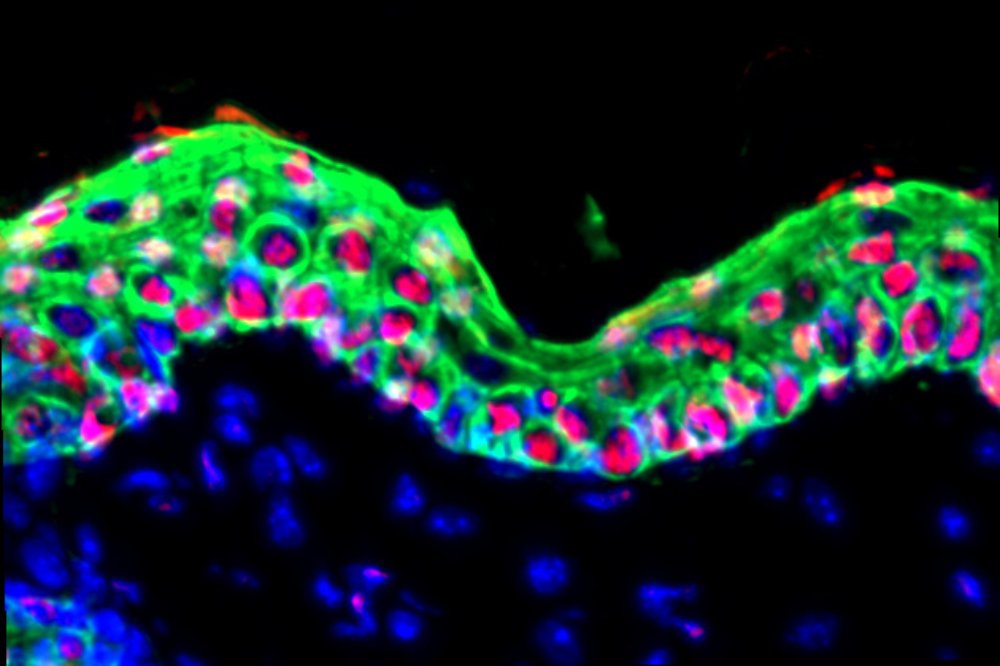 RockefellerUniv's tweet image. In a new @ScienceMagazine study, Rockefeller’s @ElaineFuchsLab has identified distinct genetic sequences of long-term inflammatory memory that can lead to chronic inflammatory skin diseases such as #psoriasis. 

🔗: bit.ly/4m57vV1