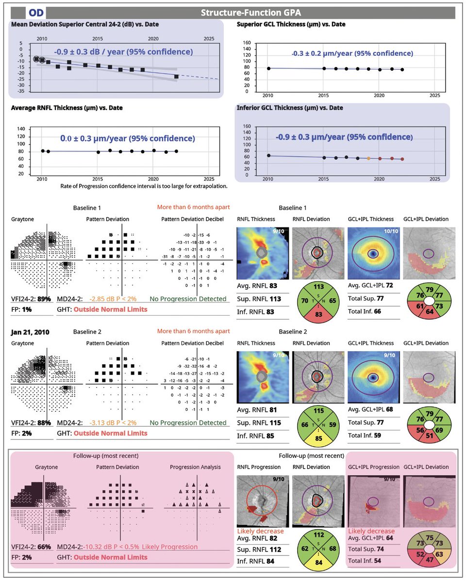 revoptom's tweet image. Optimizing Testing Strategies Across the Glaucoma Disease Spectrum

Learn how to use our essential tools—OCT and perimetry—to get the most accurate sense possible of how your patient is faring and when you should intervene.
reviewofoptometry.com/article/optimi…

#glaucoma #optometry #eyecare
