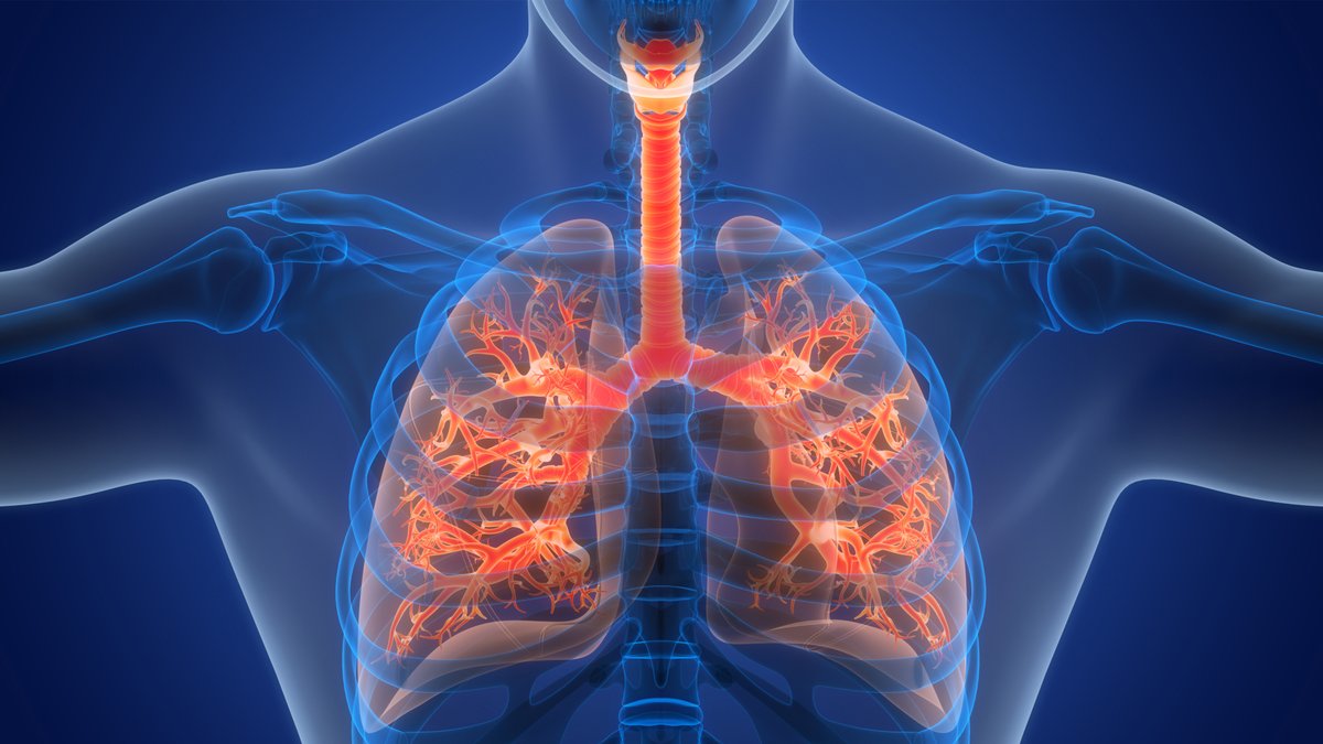 BioPharmIntl's tweet image. Could this be a COPD breakthrough? @AstraZeneca’s LUNA program shows tozorakimab (IL-33 mAb) cuts exacerbations in Phase III trials. How will IL-33 blockade impact the industry pipeline? Learn more! hubs.li/Q048FmSB0 

#COPD #DrugDevelopment #ClinicalTrials #Biopharma