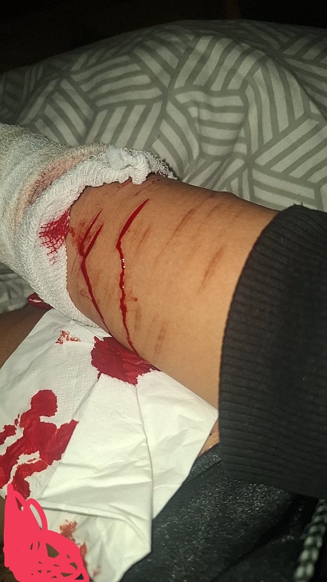 ~♡ 𝓐𝑚𝑒-𝑐ℎ𝑎𝑛 🌹💉 ~ tweet media