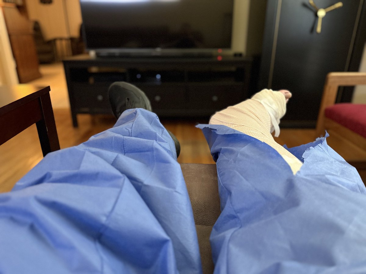 Nothing like an Achilles tear to further complicate the busiest time of the year.