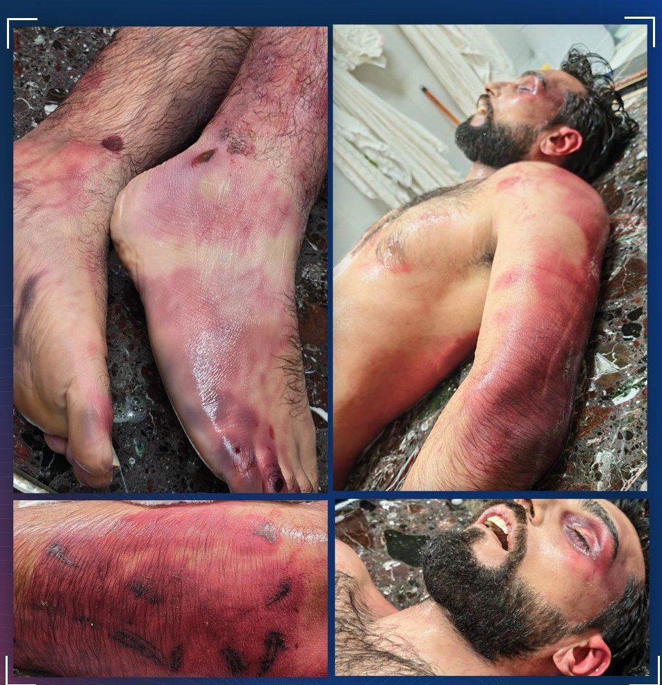 يحيى الحديد Yahya Alhadid tweet media