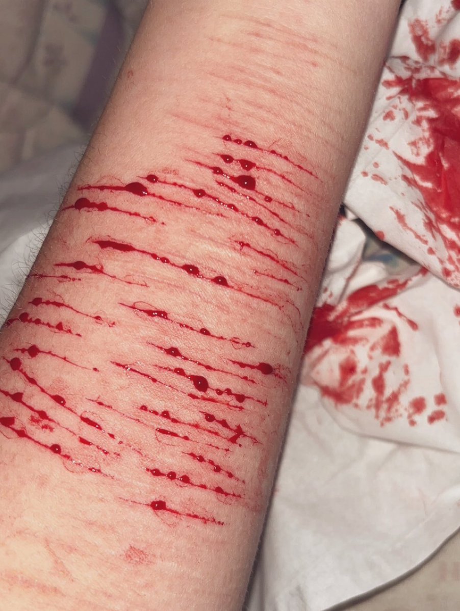 ## raine 🪽 tweet media