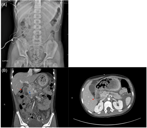 JPGN Reports tweet media