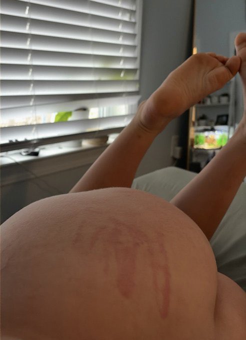 🦶Aeneas🦶 tweet media