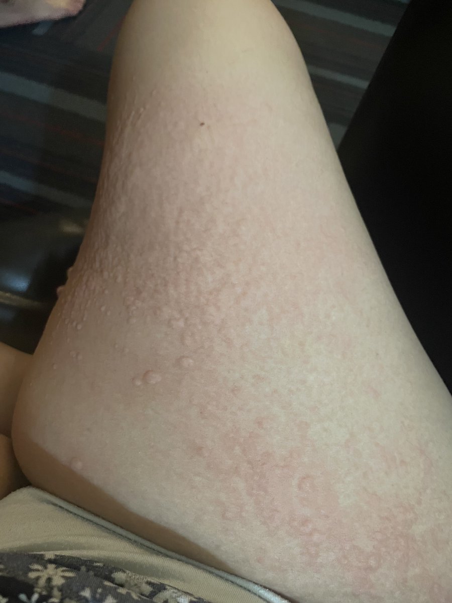 ulan🐝 tweet media