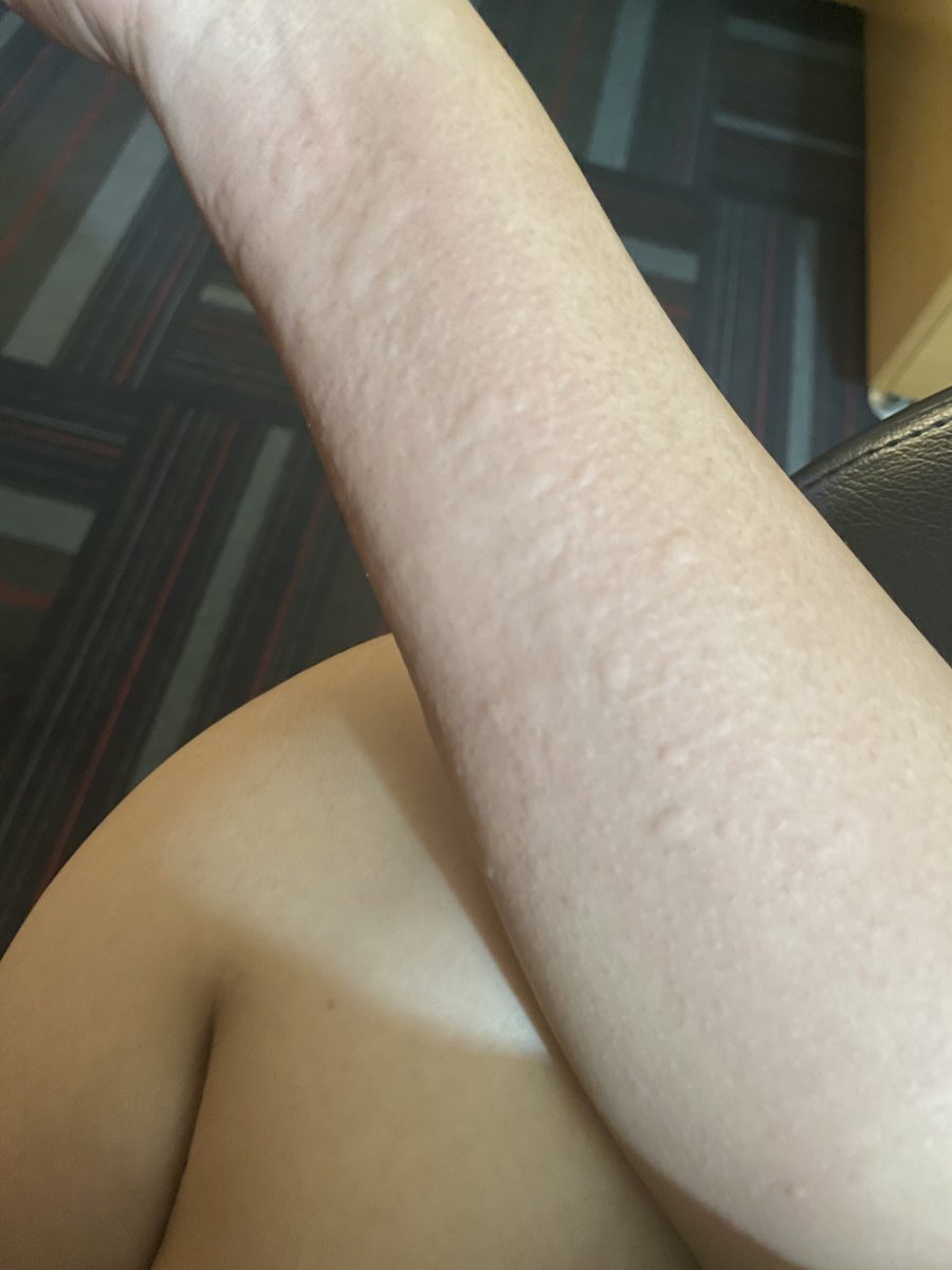 ulan🐝 tweet media