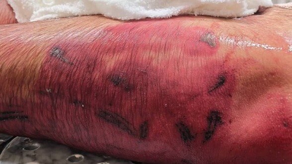 منتدى البحرين لحقوق الإنسان tweet media