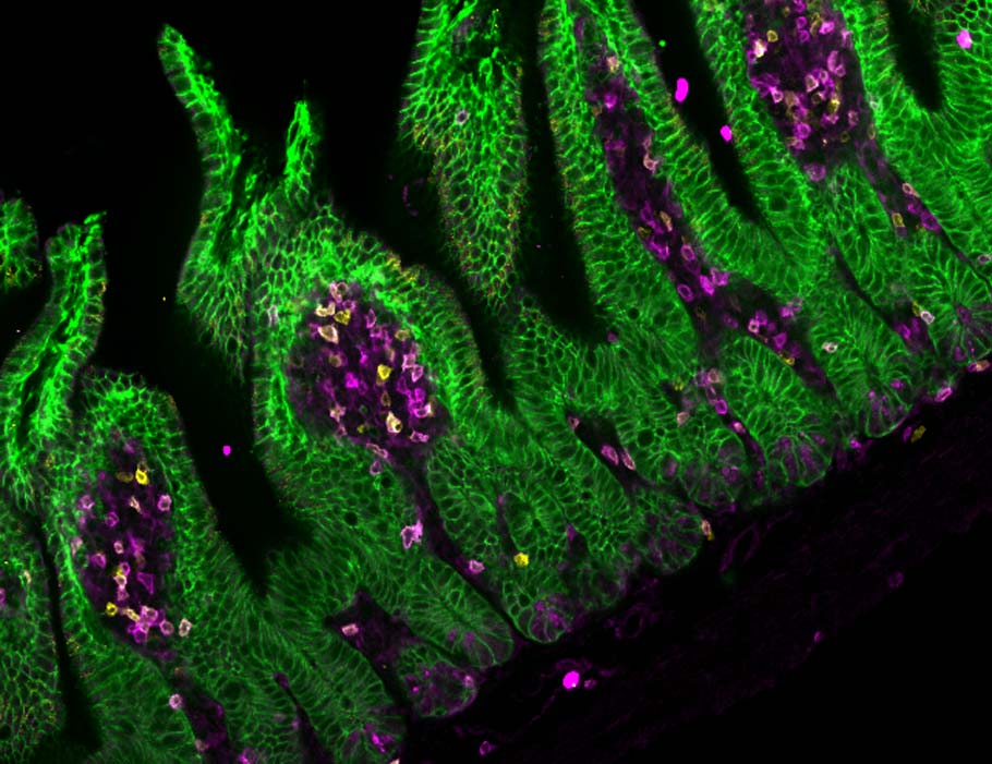 SciImmunology's tweet image. Intestinal epithelial cells upregulate MHC II and induce pathogenic T cells that migrate to the CNS, promoting symptoms of #MultipleSclerosis in mouse models.

Learn more in Science #Immunology: scim.ag/4rT0HuP #IECs